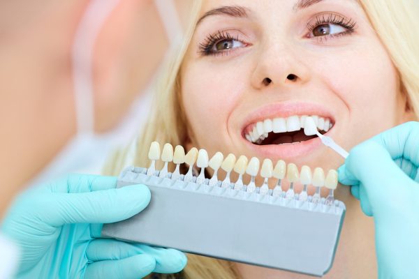 dentist matching the shade to porcelain veneers